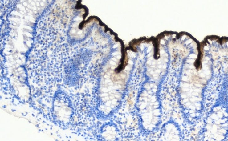 Millionär Interview 48 StoicDoc Mikroskop