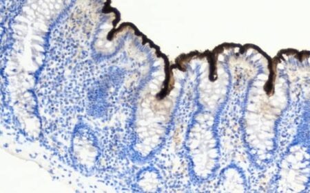 Arzt wird Selfmade-Millionär mit ETFs – So hat er es geschafft.